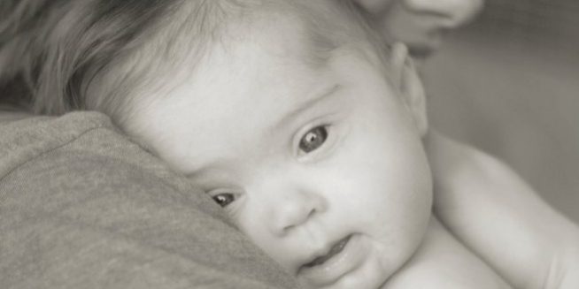 bebe-sindrome-de-down-1