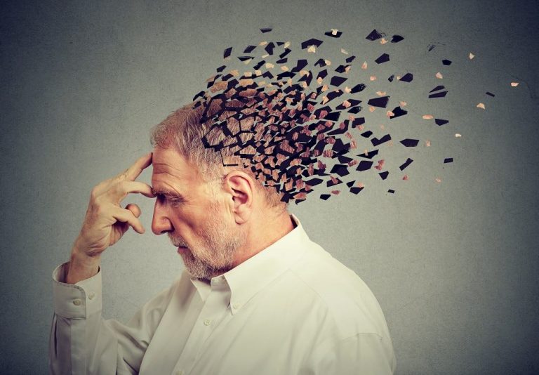 Alzheimer-shutterstock-e-Pathdoc
